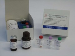大鼠β-防御素(β-DF)检测试剂盒